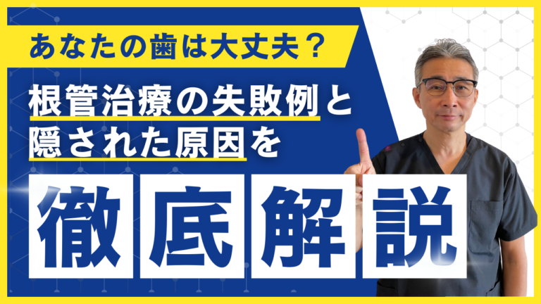 根管治療の失敗例と隠された原因を徹底解説
