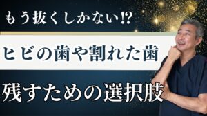 破折した歯は治せるのか？専門家が徹底解説｜歯を守るために知っておきたいこと