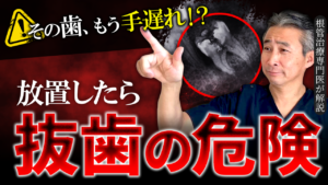 根管治療はあと何回通えば終わる？専門医が「短期で終わる理由」を解説